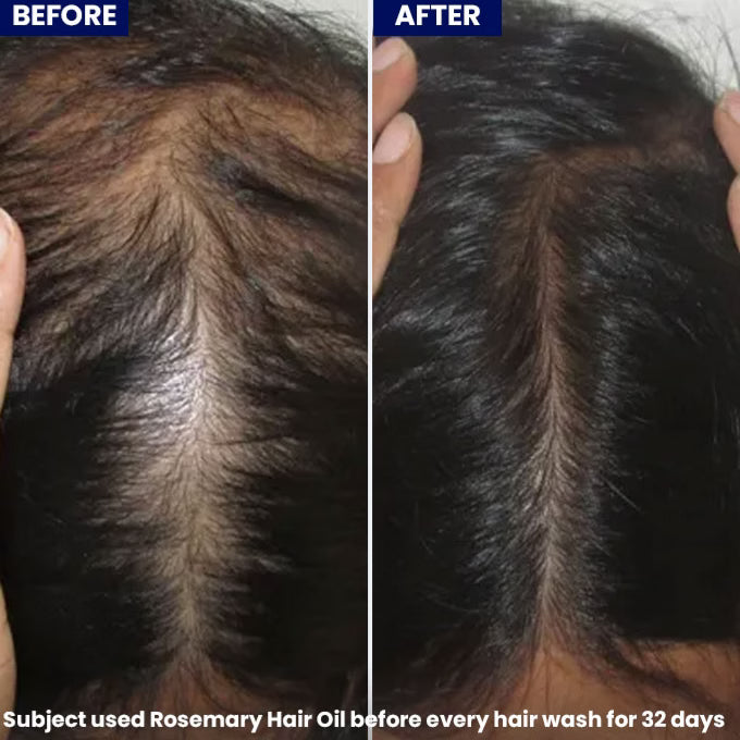 Jenpharm Anagrow Rosemary Hair Oil -  100ml