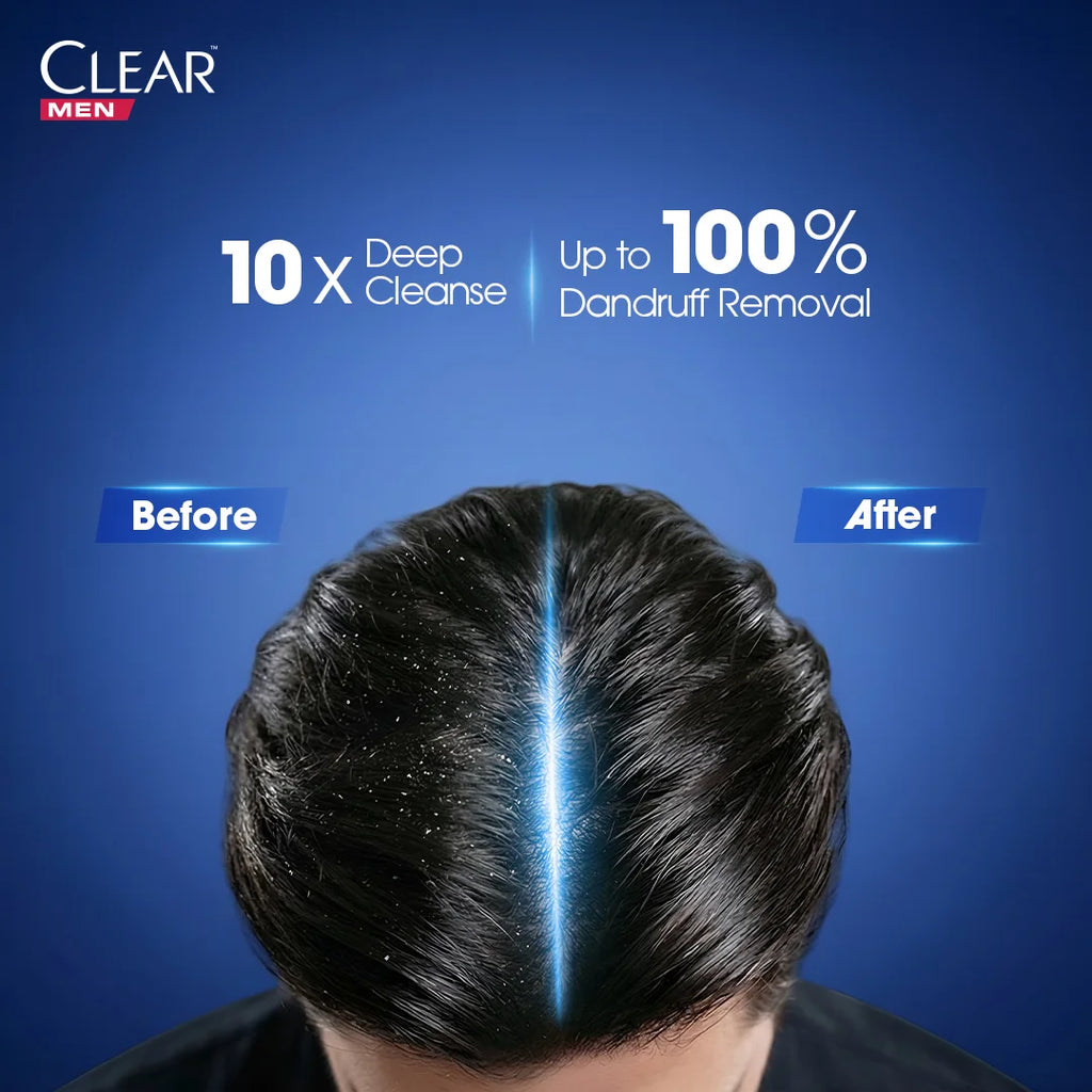 Clear Men Deep Cleanse Anti Dandruff Shampoo - 380ml