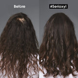 Loreal Professionnel Serie Expert Serioxyl Denser Hair Serum- 90ml - Anti Hair Fall