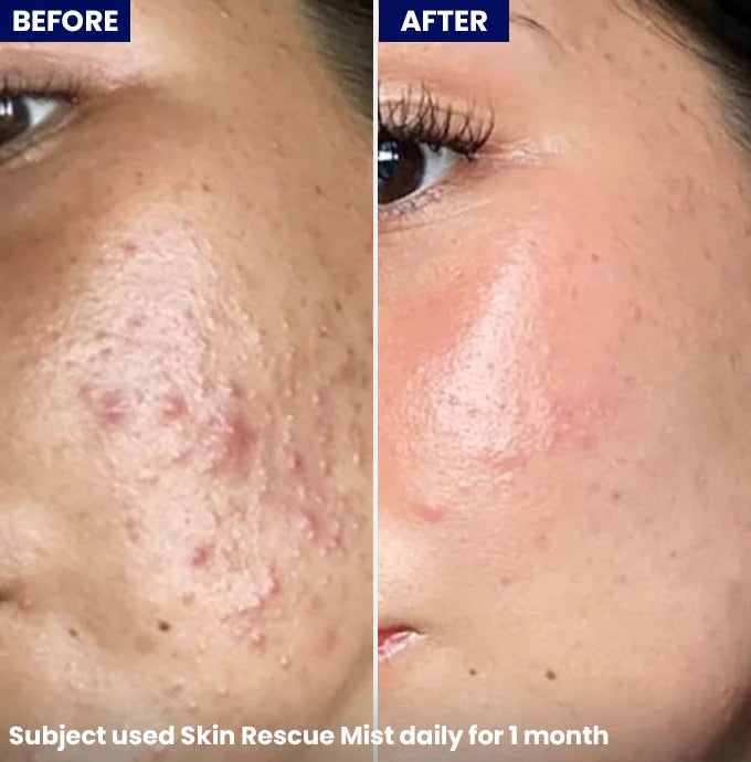 Jenpharm Skin Rescue Mist - 100ml