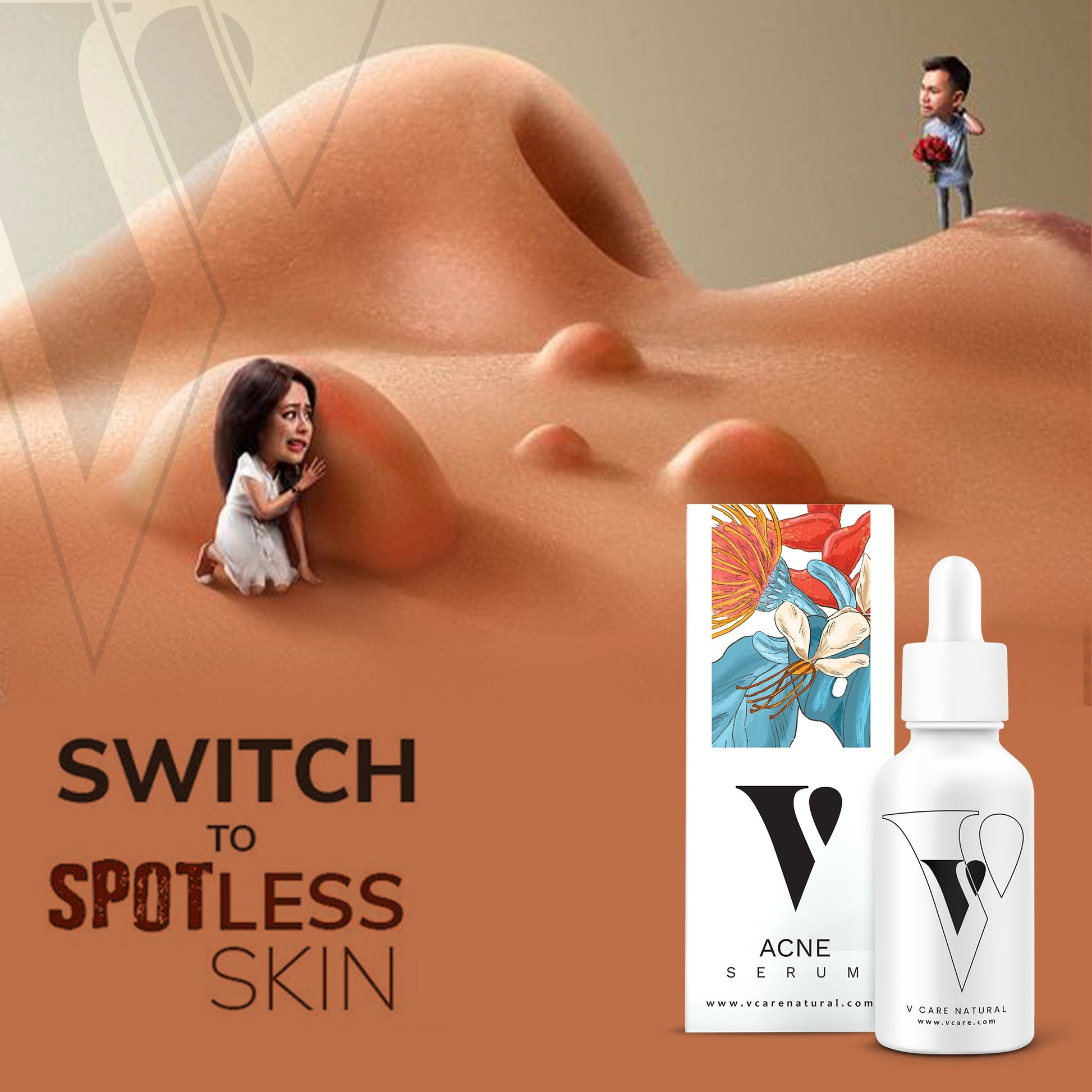 Acne Serum - Vcare Natural