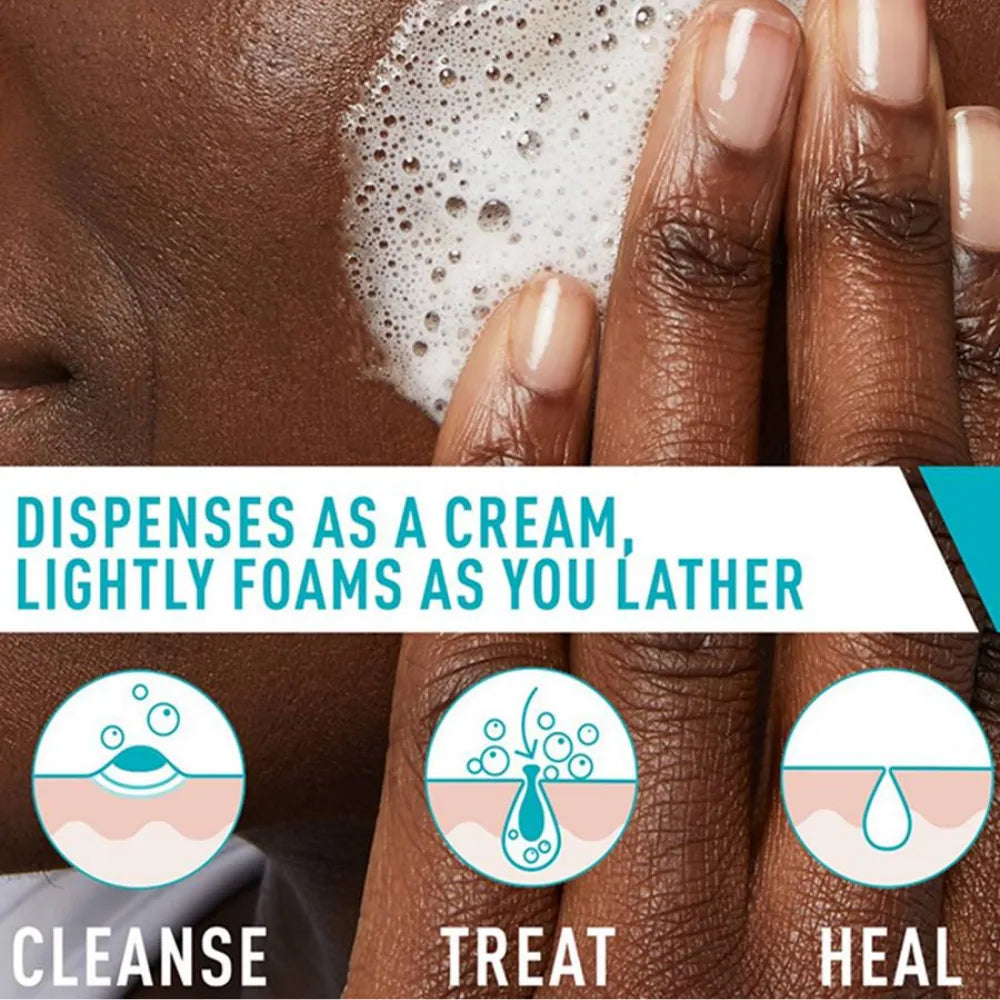 CeraVe Acne Foaming Cream Cleanser 4% BPO - 150ml