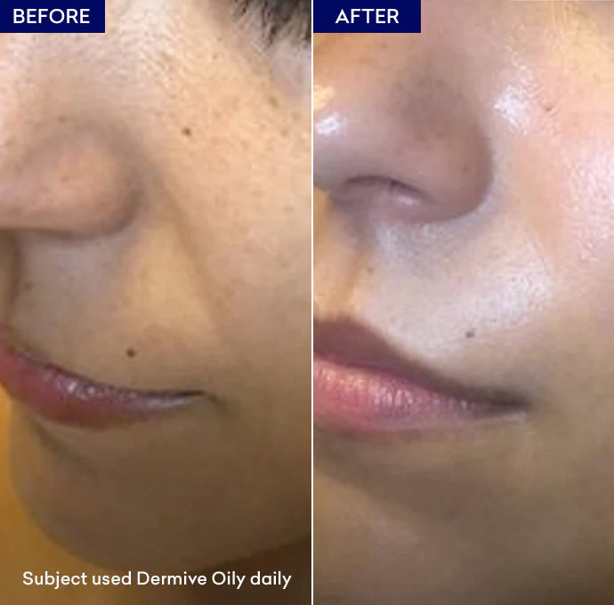 Jenpharm Dermive Oily Moisturizer