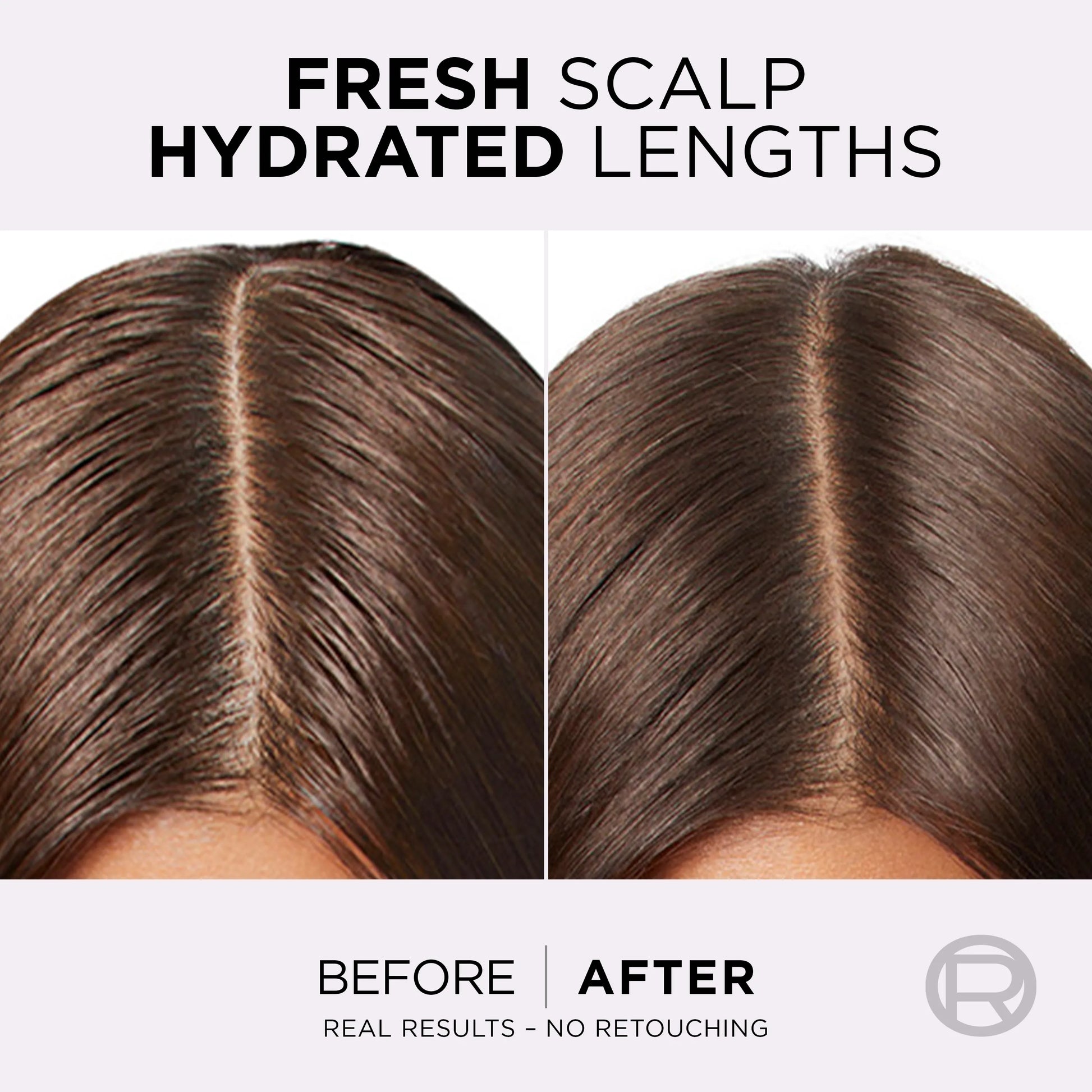 LOreal Paris Elvive Hyaluron Pure Shampoo - 175ml