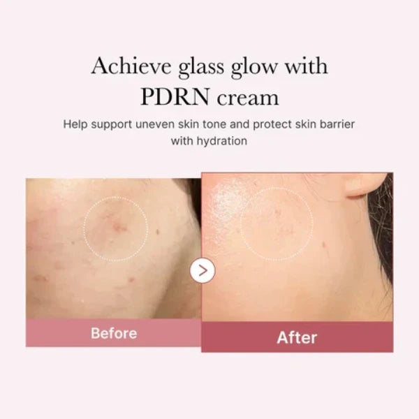 Medicube Pink Hyaluronic Moisturizing Cream - 50ml