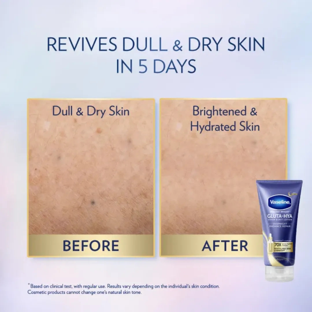 Vaseline Gluta-Hya Serum Burst Lotion Overnight Radiance Repair - 300ml