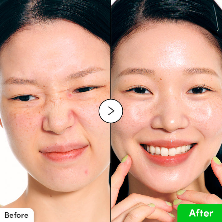 Eqqual Berry Aloe PDRN Calming Serum - 30ml