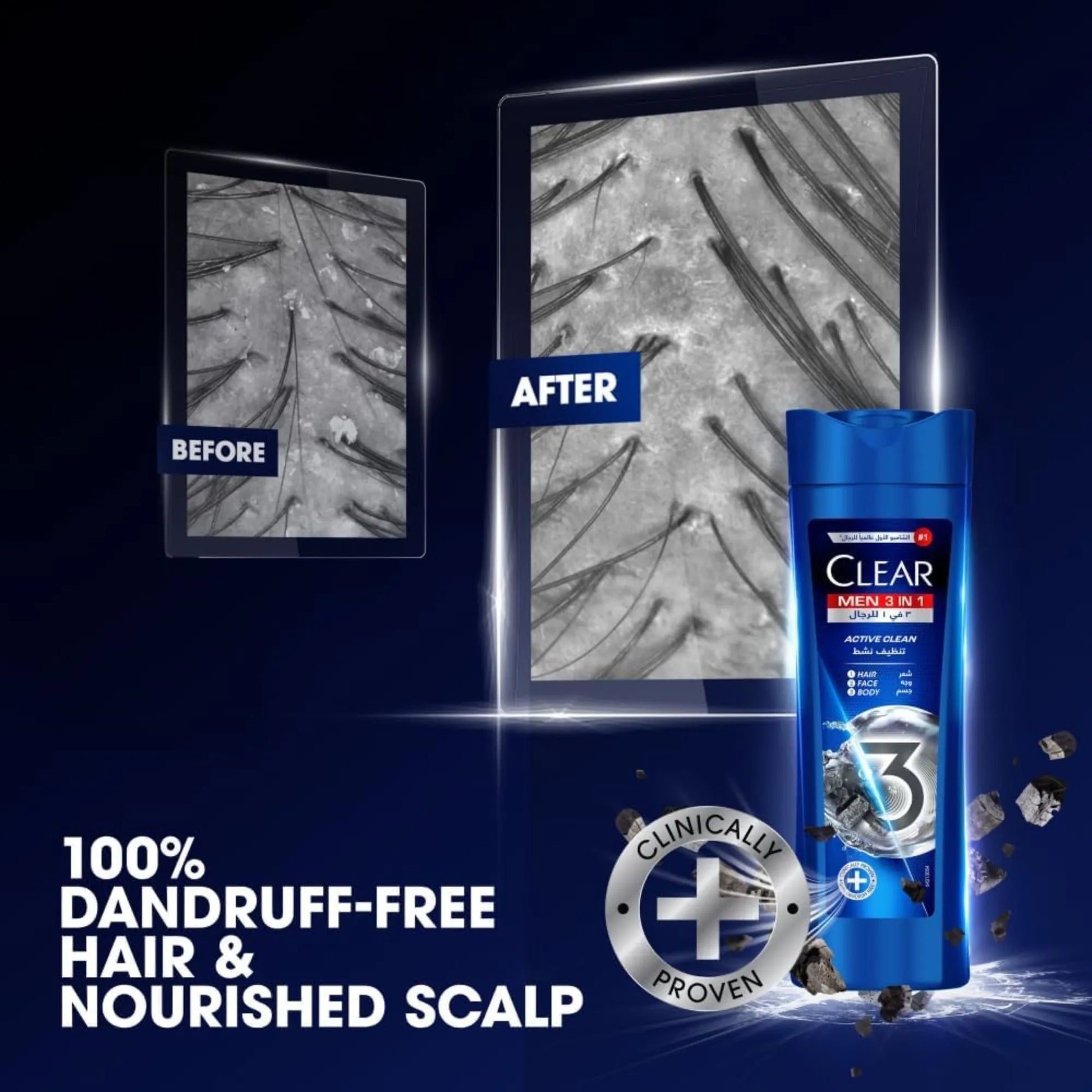 Clear Men 3 in 1 Active Clean - 400ml