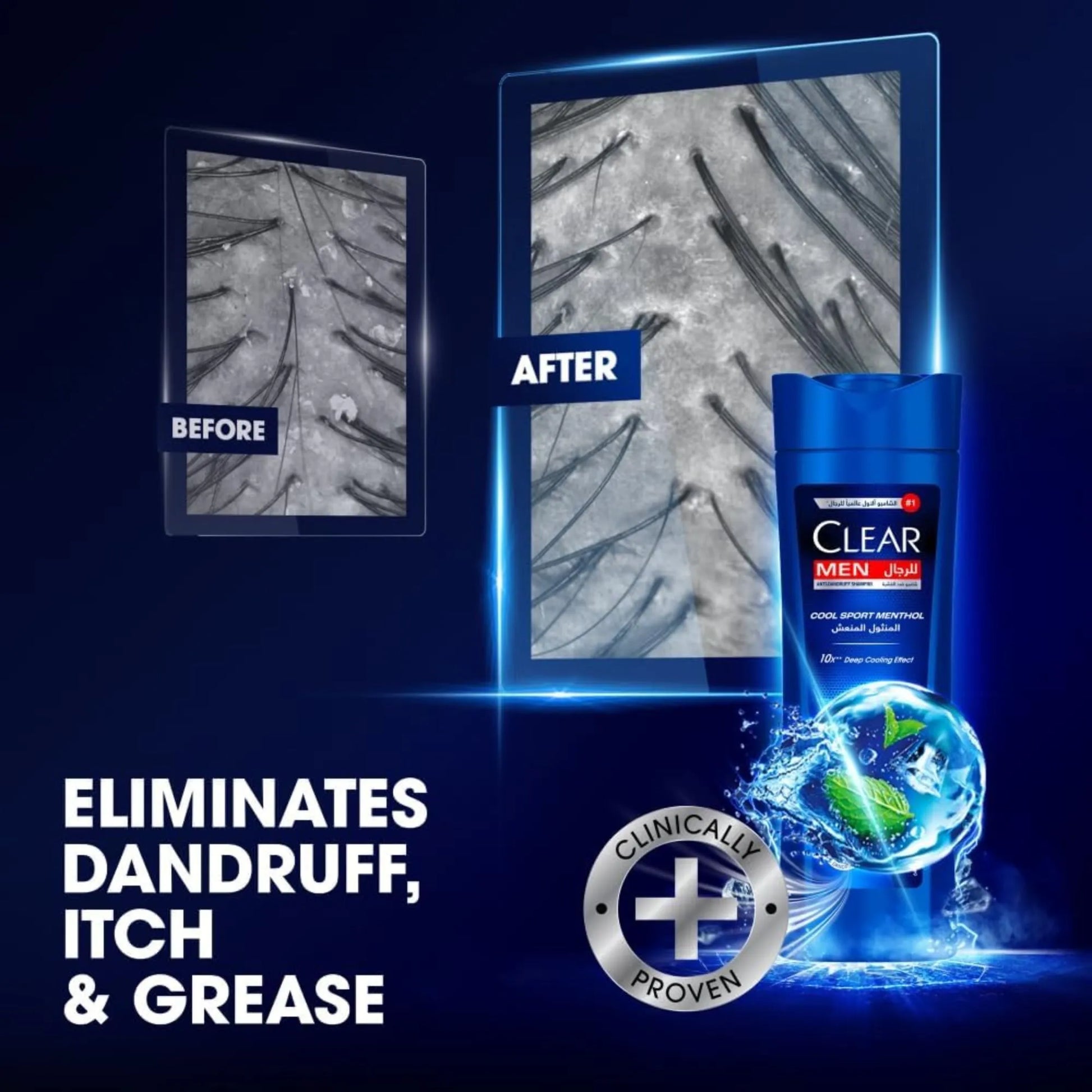 Clear Men Cool Sport Menthol Anti Dandruff Shampoo - 200ml