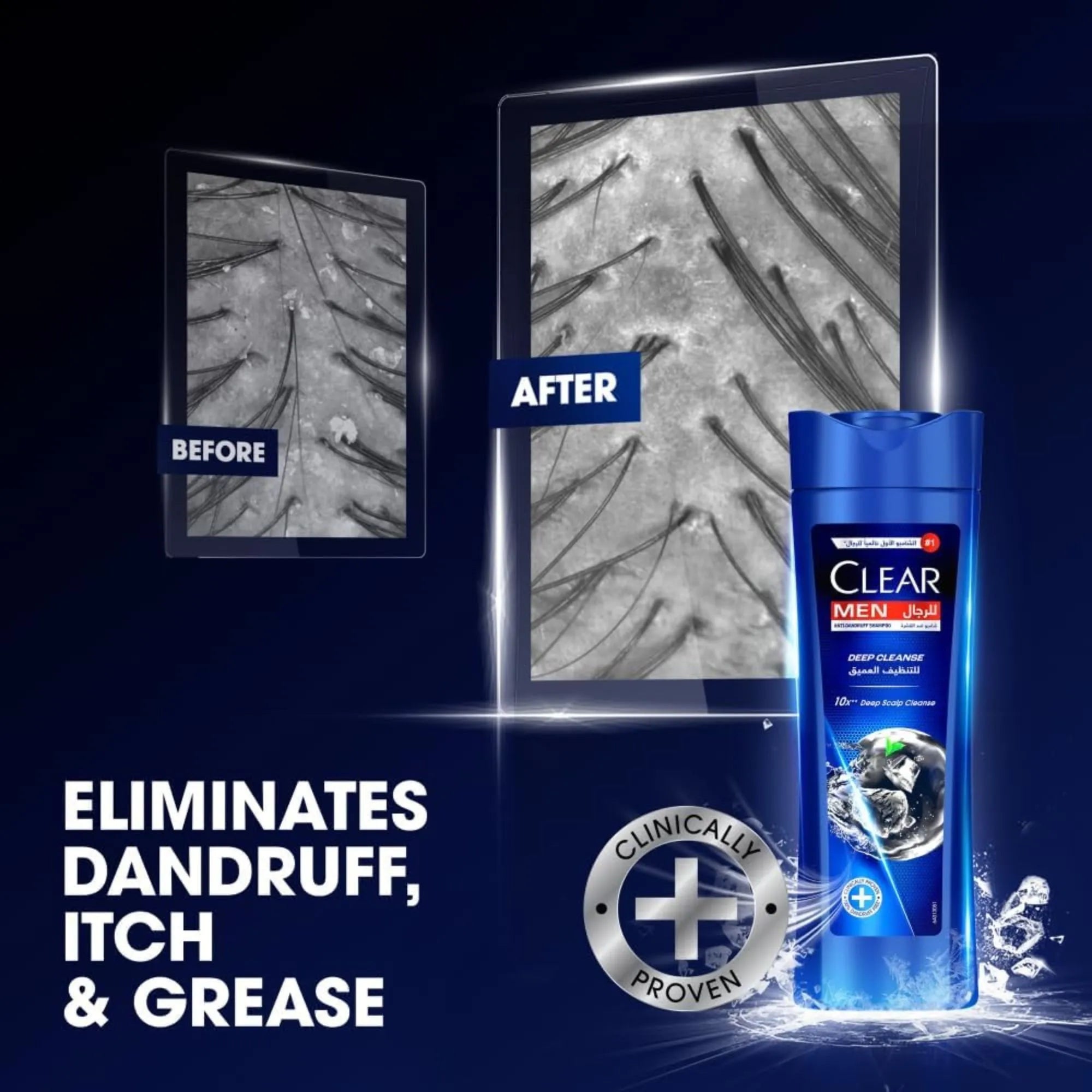 Clear Men Deep Cleanse Anti Dandruff Shampoo - 200ml