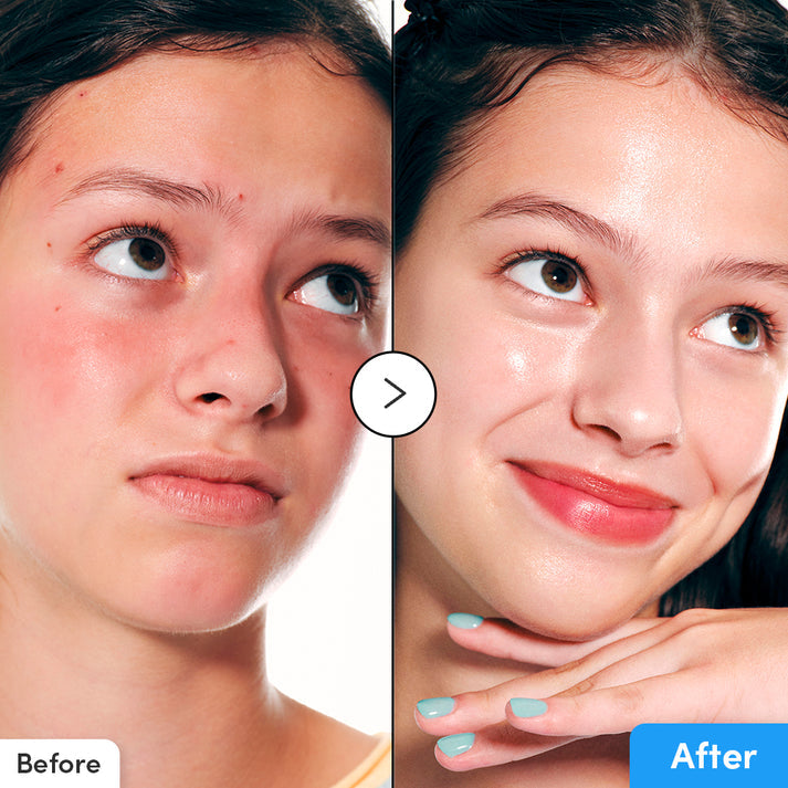 Eqqual Berry Hyaltoin Flooding Serum - 30ml