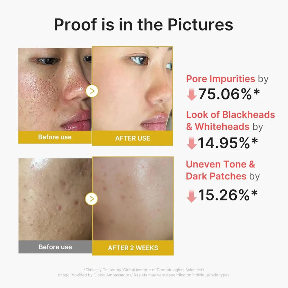Medicube Kojic Acid Turmeric Peel Shot - 80ml
