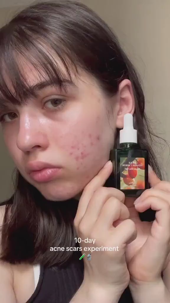 Dr. Althea Gentle Vitamin C Serum - 30ml