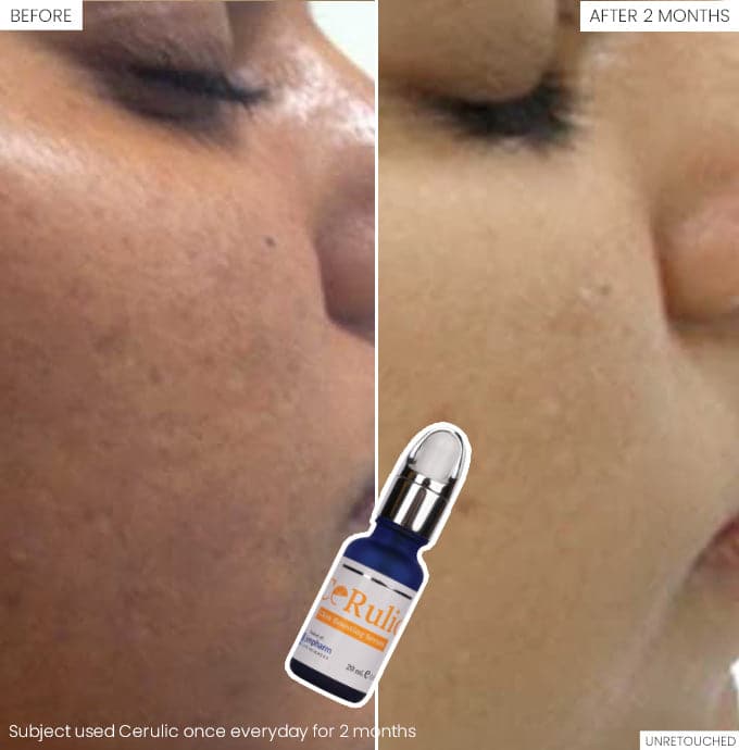 Jenpharm Cerulic Glow Boosting Serum Cozmetica jenpharm-cerulic-glow-boosting-serum-cozmetica